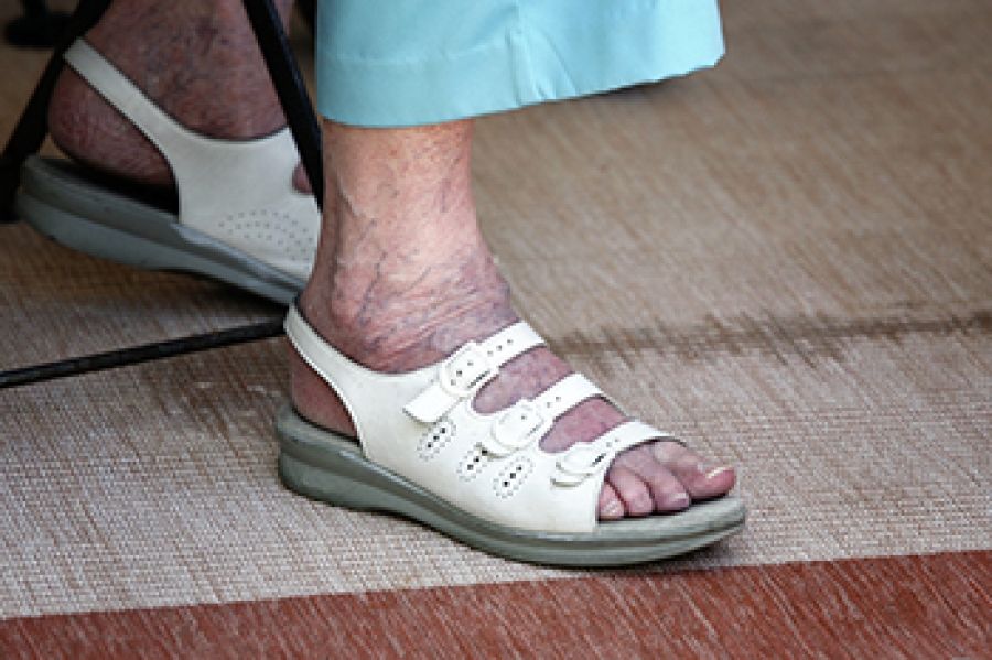 The Importance Of Caring For Elderly Feet